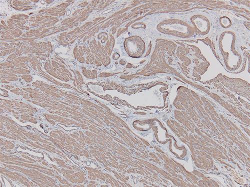 3003B | Control Slides:Immunopathology; Actin, Smooth Muscle